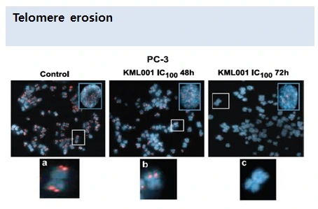 Microscope images of cancer-cell telomere erosion after Kominox treatment
